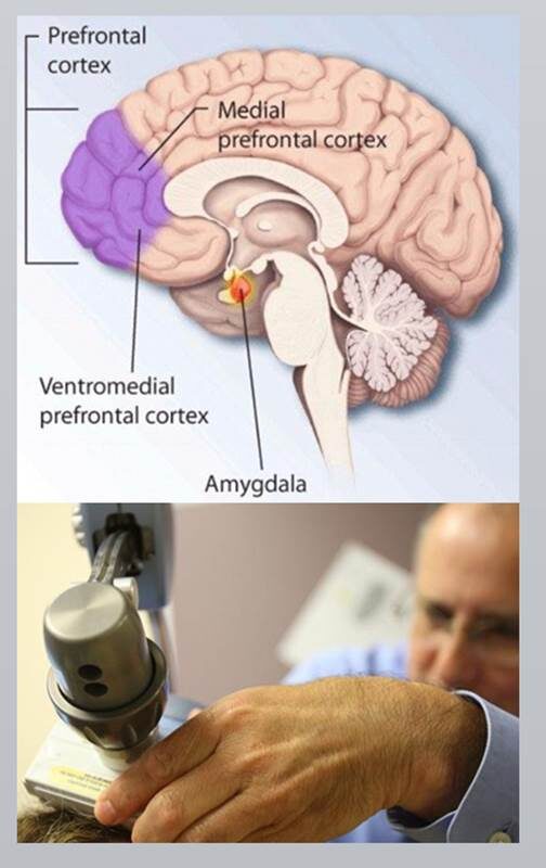 neuromodulating20ideology2c202-9803337